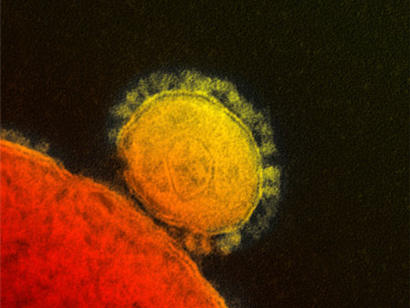 国家卫健委：将新型冠状病毒肺炎更名为新型冠状病毒感染